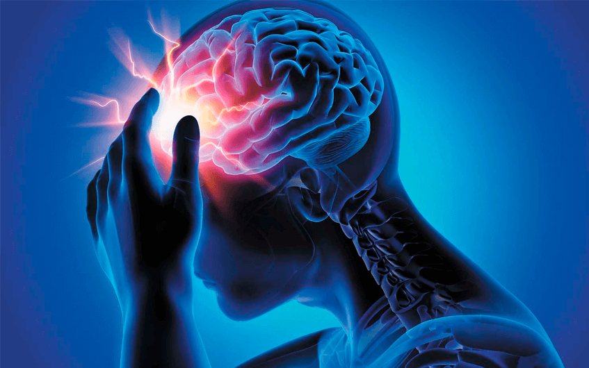 Representação 3D da dor de cabeça masculina